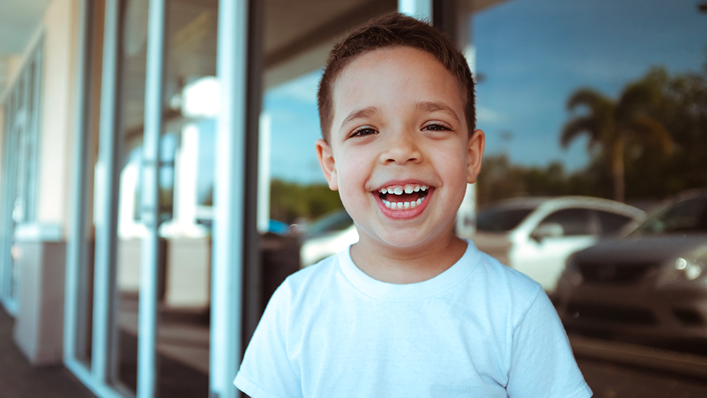 Il diastema interincisivo, il piccolo spazio tra i denti superiori. Quando e come va trattato?